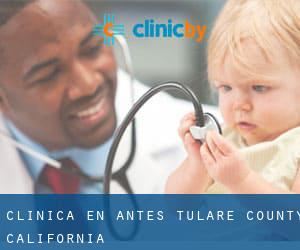clínica en Antes (Tulare County, California)